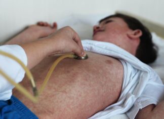 Канада втратила статус країни без ендемічного кору