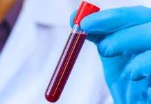 Кров Довгожителів Розкриває Секрети Уповільненого Старіння: Виявлено 37 білкових маркерів