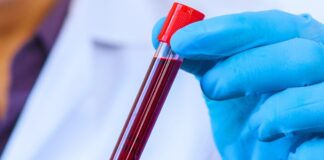 Кров Довгожителів Розкриває Секрети Уповільненого Старіння: Виявлено 37 білкових маркерів