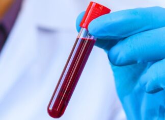 Кров Довгожителів Розкриває Секрети Уповільненого Старіння: Виявлено 37 білкових маркерів