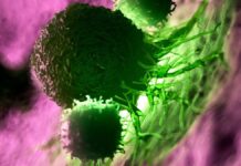 Personalisierte mRNA-Impfstoffe sind vielversprechend im langfristigen Kampf gegen Bauchspeicheldrüsenkrebs