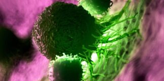 Personalisierte mRNA-Impfstoffe sind vielversprechend im langfristigen Kampf gegen Bauchspeicheldrüsenkrebs